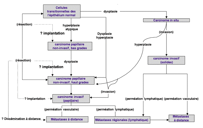 Tumeur Urotheliale De Haut Grade