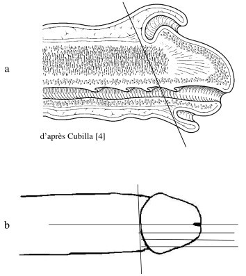 http://www.urofrance.org/fileadmin/documents/data/PU/2005/PU-2005-00150805-4-2/Images/fig%206.jpg