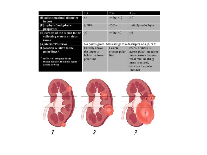 Urofrance Comment gérer les complications de la néphrectomie — free download