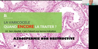 Prise en charge de l&rsquo;homme infertile en Urologie