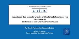 Implantation d’un sphincter urinaire artificiel chez la femme par voie robot assistée : 12 étapes clés pour une implantation réussie